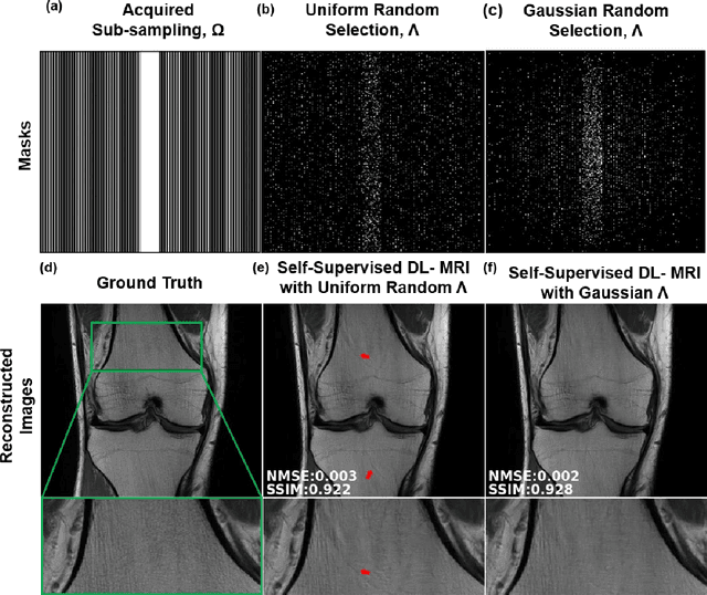 Figure 3 for Self-Supervised Learning of Physics-Based Reconstruction Neural Networks without Fully-Sampled Reference Data