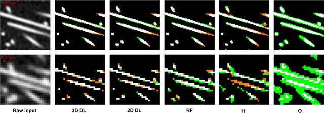 Figure 3 for Fully Convolutional Deep Network Architectures for Automatic Short Glass Fiber Semantic Segmentation from CT scans