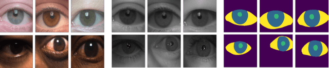 Figure 1 for BiOcularGAN: Bimodal Synthesis and Annotation of Ocular Images