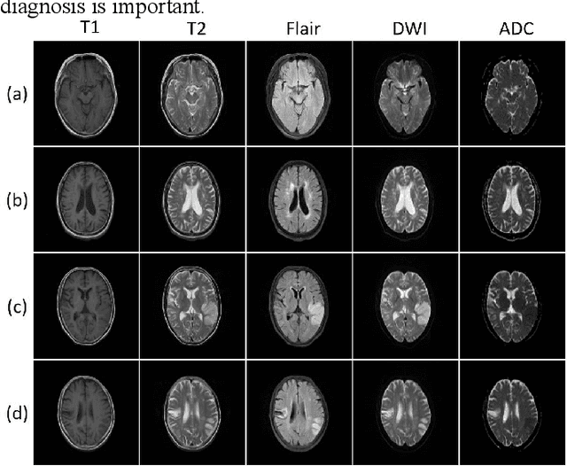 Figure 2 for A coarse-to-fine framework for unsupervised multi-contrast MR image deformable registration with dual consistency constraint