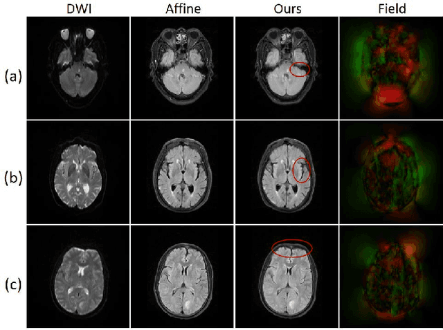 Figure 1 for A coarse-to-fine framework for unsupervised multi-contrast MR image deformable registration with dual consistency constraint