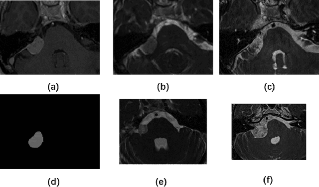 Figure 3 for Unsupervised Domain Adaptation in Semantic Segmentation Based on Pixel Alignment and Self-Training