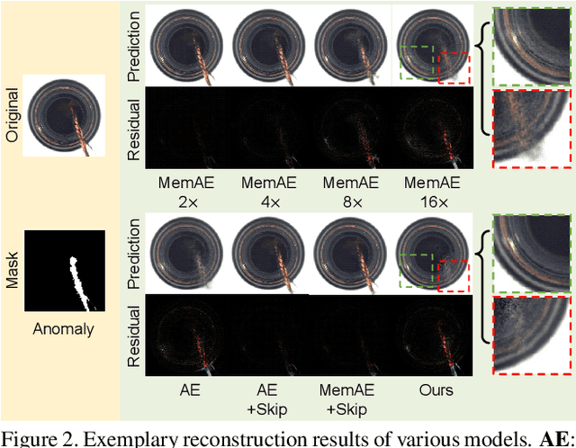 Figure 3 for Divide-and-Assemble: Learning Block-wise Memory for Unsupervised Anomaly Detection