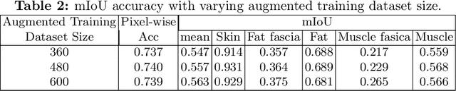 Figure 4 for W-Net: Dense Semantic Segmentation of Subcutaneous Tissue in Ultrasound Images by Expanding U-Net to Incorporate Ultrasound RF Waveform Data