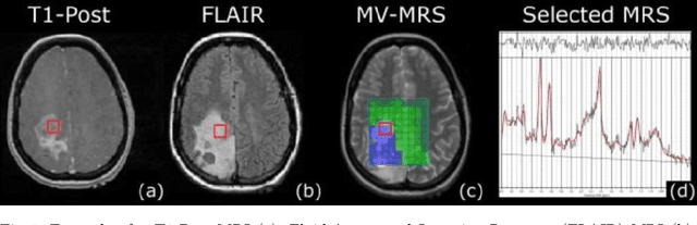 Figure 1 for Generating Magnetic Resonance Spectroscopy Imaging Data of Brain Tumours from Linear, Non-Linear and Deep Learning Models