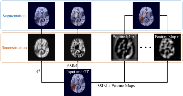 Figure 1 for Unsupervised Anomaly Localization with Structural Feature-Autoencoders