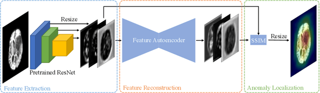 Figure 3 for Unsupervised Anomaly Localization with Structural Feature-Autoencoders