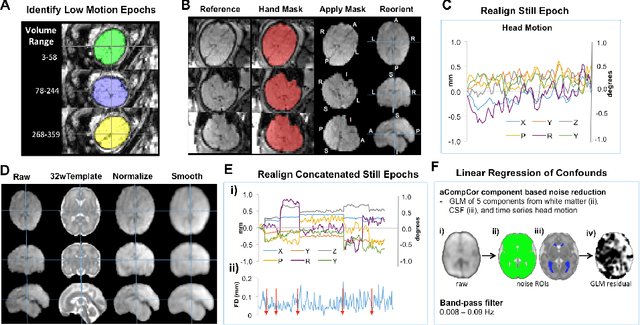 Figure 1 for Interpreting Age Effects of Human Fetal Brain from Spontaneous fMRI using Deep 3D Convolutional Neural Networks