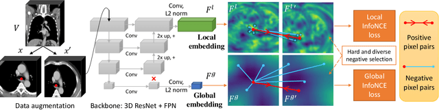 Figure 3 for Self-supervised Learning of Pixel-wise Anatomical Embeddings in Radiological Images