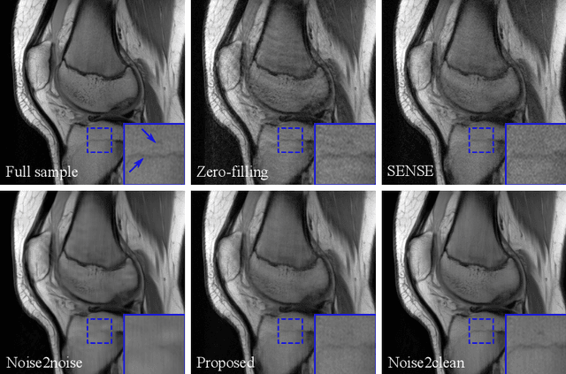 Figure 3 for Consensus Neural Network for Medical Imaging Denoising with Only Noisy Training Samples