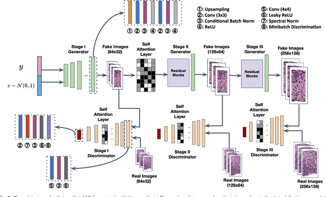 Figure 4 for Selective Synthetic Augmentation with HistoGAN for Improved Histopathology Image Classification
