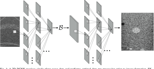 Figure 1 for Single Plane-Wave Imaging using Physics-Based Deep Learning