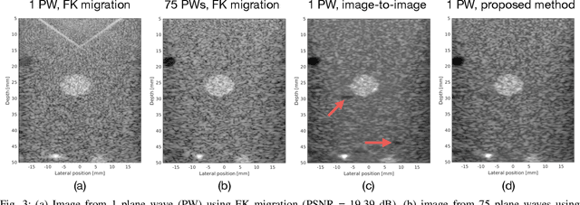 Figure 3 for Single Plane-Wave Imaging using Physics-Based Deep Learning