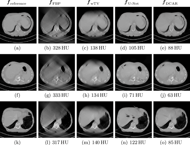 Figure 3 for Data Consistent Artifact Reduction for Limited Angle Tomography with Deep Learning Prior