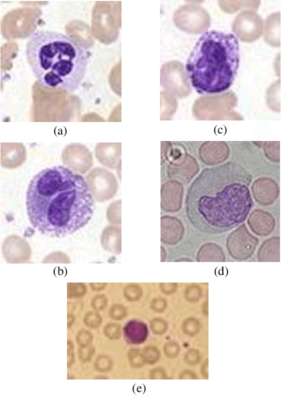 Figure 1 for High Accuracy Classification of White Blood Cells using TSLDA Classifier and Covariance Features