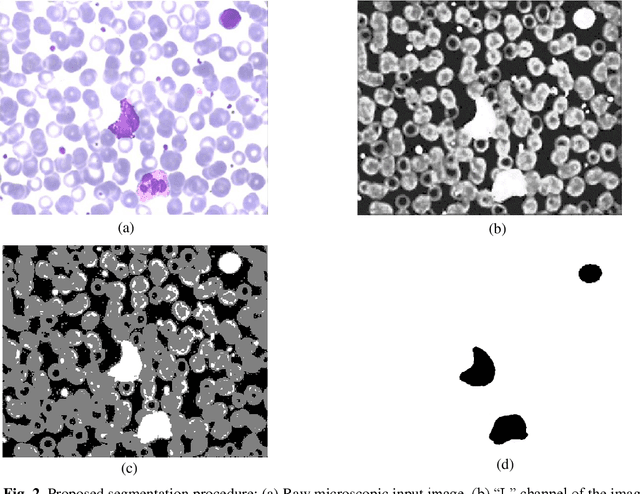 Figure 3 for High Accuracy Classification of White Blood Cells using TSLDA Classifier and Covariance Features