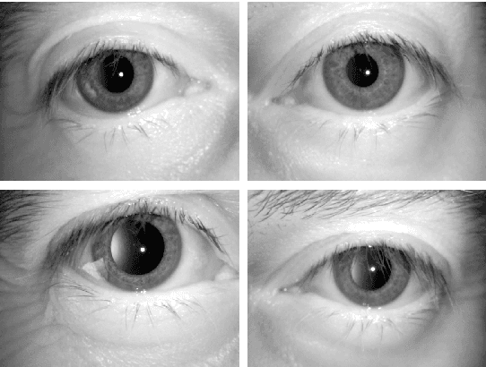 Figure 3 for Alcohol Consumption Detection from Periocular NIR Images Using Capsule Network