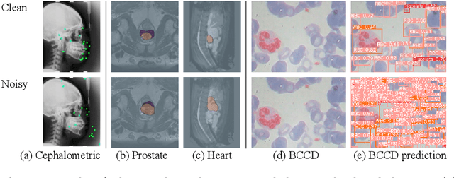 Figure 1 for Adaptive Adversarial Training to Improve Adversarial Robustness of DNNs for Medical Image Segmentation and Detection
