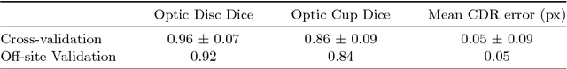 Figure 2 for A Deep Learning based Joint Segmentation and Classification Framework for Glaucoma Assesment in Retinal Color Fundus Images
