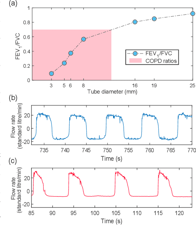 Figure 2 for An Apparatus for the Simulation of Breathing Disorders: Physically Meaningful Generation of Surrogate Data