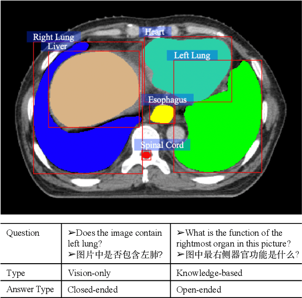 Figure 1 for SLAKE: A Semantically-Labeled Knowledge-Enhanced Dataset for Medical Visual Question Answering