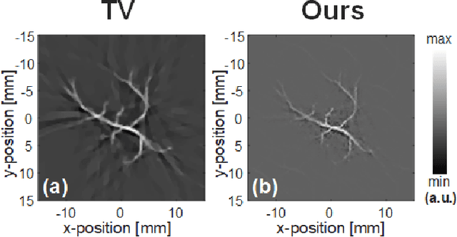 Figure 4 for Compressed Sensing for Photoacoustic Computed Tomography Using an Untrained Neural Network