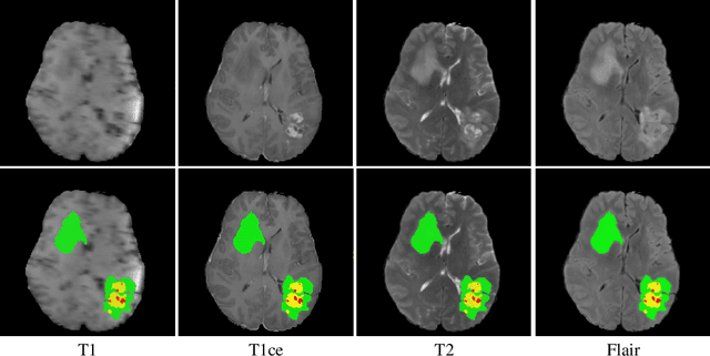 Figure 1 for H2NF-Net for Brain Tumor Segmentation using Multimodal MR Imaging: 2nd Place Solution to BraTS Challenge 2020 Segmentation Task