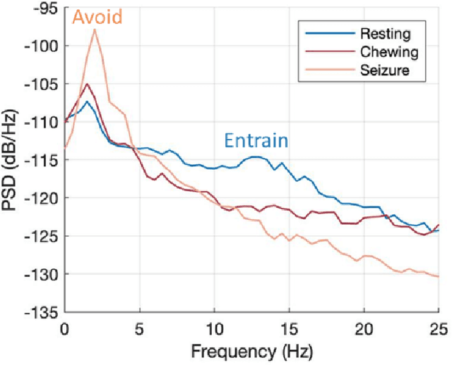 Figure 2 for Embedding digital chronotherapy into medical devices -- A canine case study in controlling status epilepticus through multi-scale rhythmic brain stimulation