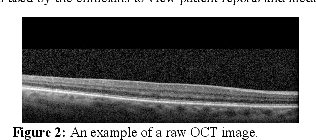 Figure 3 for Efficient OCT Image Segmentation Using Neural Architecture Search