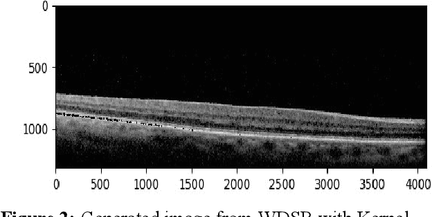 Figure 4 for Efficient OCT Image Segmentation Using Neural Architecture Search