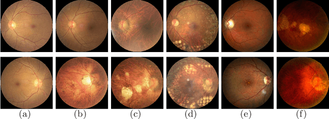 Figure 1 for A Benchmark of Ocular Disease Intelligent Recognition: One Shot for Multi-disease Detection