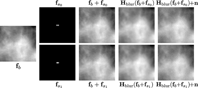 Figure 3 for Impact of deep learning-based image super-resolution on binary signal detection