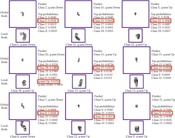 Figure 3 for Varifocal-Net: A Chromosome Classification Approach using Deep Convolutional Networks