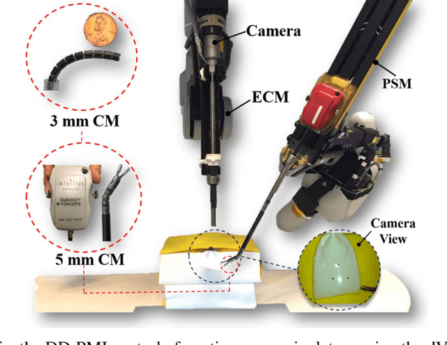 Figure 2 for A Versatile Data-Driven Framework for Model-Independent Control of Continuum Manipulators Interacting With Obstructed Environments With Unknown Geometry and Stiffness