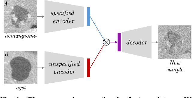 Figure 1 for Improving CNN Training using Disentanglement for Liver Lesion Classification in CT