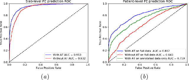 Figure 4 for Automatic Diagnosis of Pulmonary Embolism Using an Attention-guided Framework: A Large-scale Study