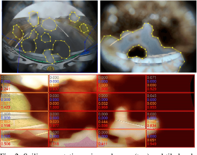Figure 2 for TiledSoilingNet: Tile-level Soiling Detection on Automotive Surround-view Cameras Using Coverage Metric
