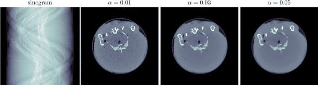Figure 4 for Synergistic Multi-spectral CT Reconstruction with Directional Total Variation