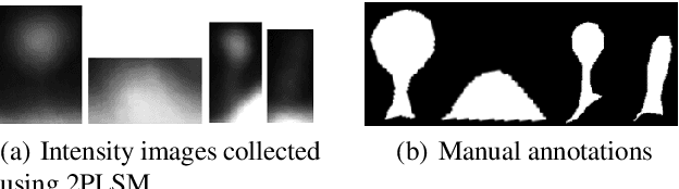 Figure 2 for Dendritic Spine Shape Analysis: A Clustering Perspective