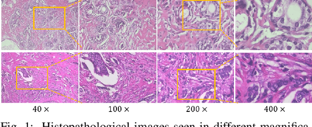 Figure 1 for Magnification-independent Histopathological Image Classification with Similarity-based Multi-scale Embeddings