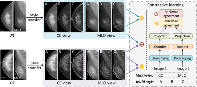 Figure 3 for Domain Generalization for Mammography Detection via Multi-style and Multi-view Contrastive Learning
