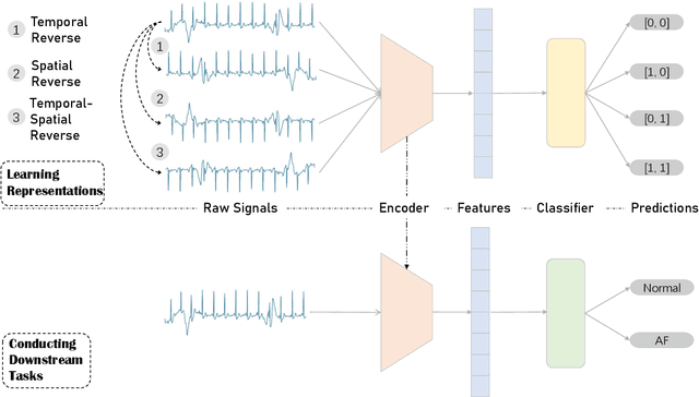 Figure 1 for Learning ECG Representations based on Manipulated Temporal-Spatial Reverse Detection