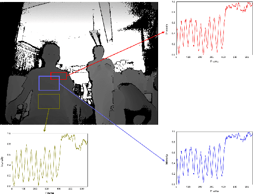 Figure 1 for Abnormal respiratory patterns classifier may contribute to large-scale screening of people infected with COVID-19 in an accurate and unobtrusive manner