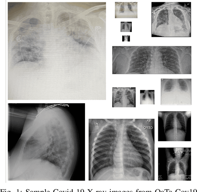 Figure 1 for Convolutional Sparse Support Estimator Based Covid-19 Recognition from X-ray Images