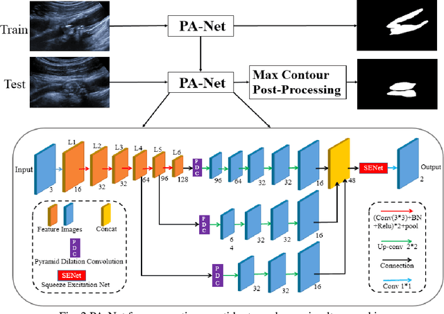 Figure 3 for Parallel Network with Channel Attention and Post-Processing for Carotid Arteries Vulnerable Plaque Segmentation in Ultrasound Images