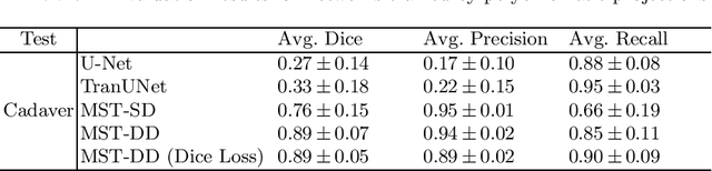 Figure 4 for Simulation-Driven Training of Vision Transformers Enabling Metal Segmentation in X-Ray Images