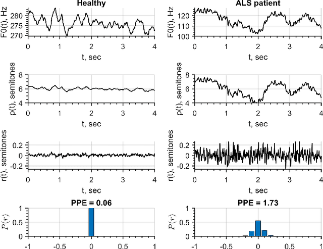 Figure 3 for Classification of ALS patients based on acoustic analysis of sustained vowel phonations