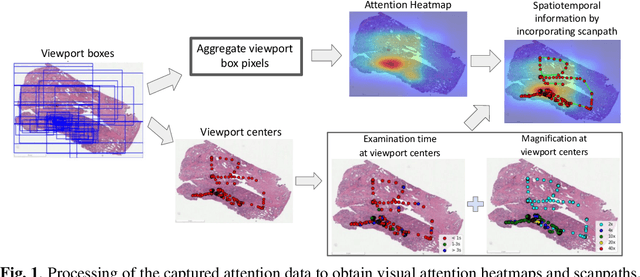 Figure 1 for Visual attention analysis of pathologists examining whole slide images of Prostate cancer