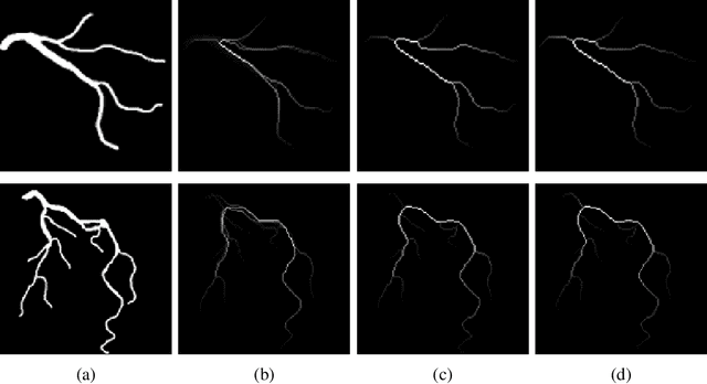 Figure 3 for Topological Similarity Index and Loss Function for Blood Vessel Segmentation