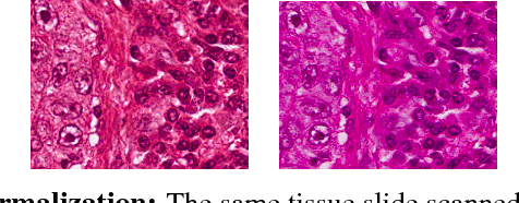 Figure 1 for Fast GPU-Enabled Color Normalization for Digital Pathology